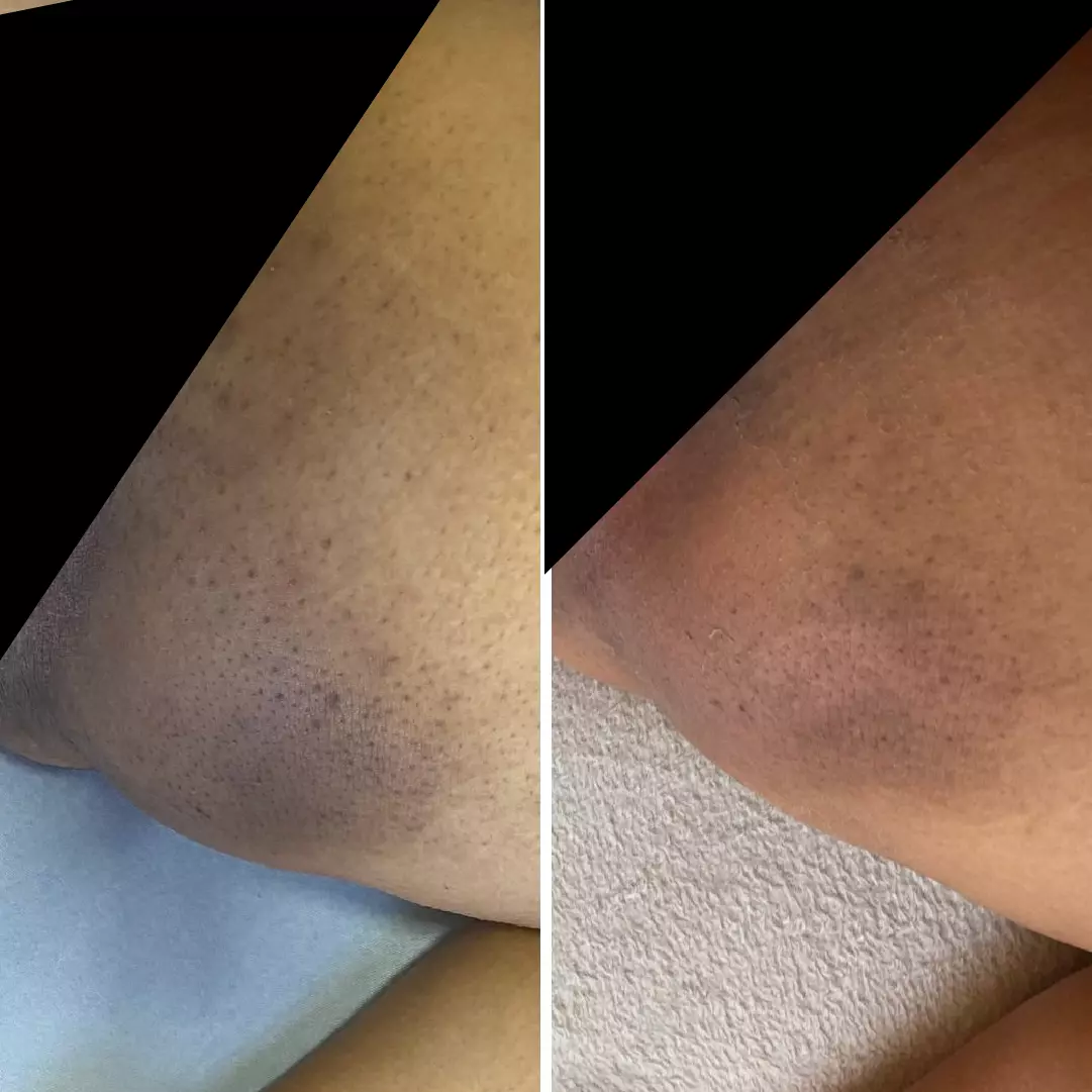 Home 17 AnyConv.com__resultado 10