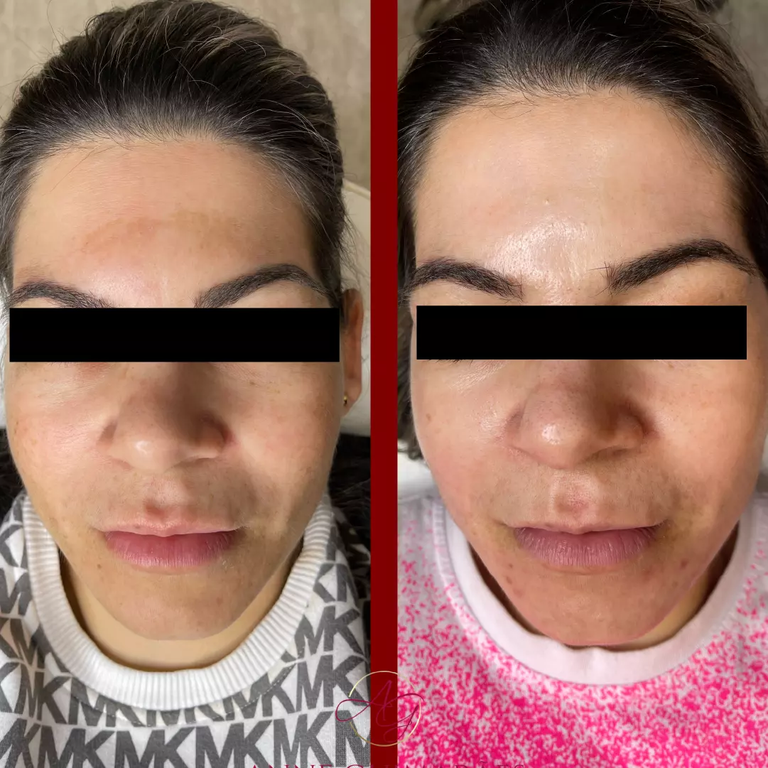 Home 14 AnyConv.com__resultado 5