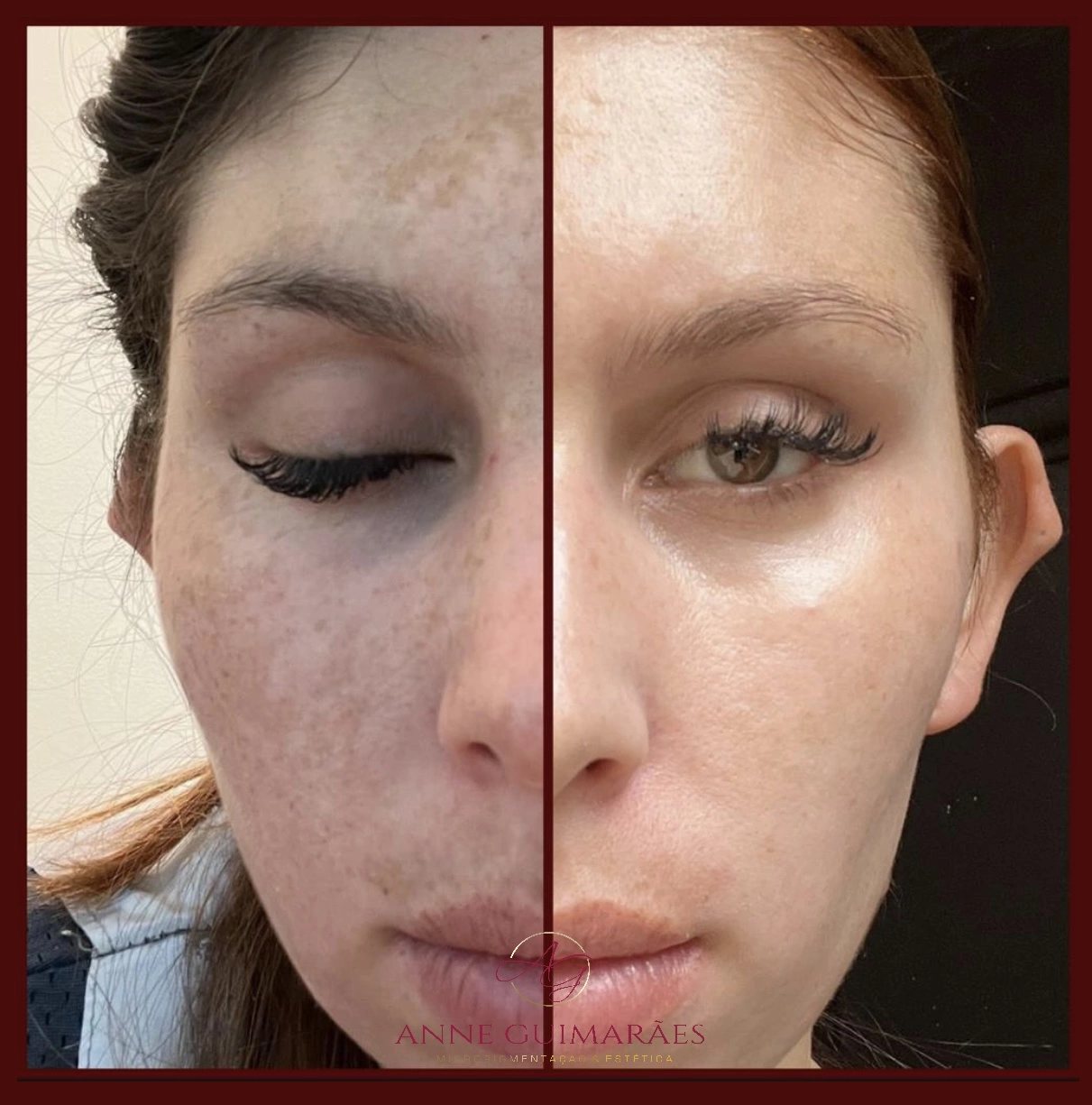 Home 9 depoimentos-anne-12-1.webp